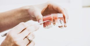 Detailed Insight on Dentures