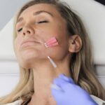Why Choose Mono Threads for Non-Surgical Skin Lifting?